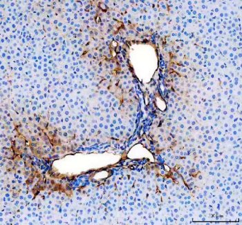 IHC staining of FFPE rat liver tissue with Cd31 antibody, HRP-secondary and DAB substrate. HIER: boil tissue sections in pH8 EDTA for 20 min and allow to cool before testing.