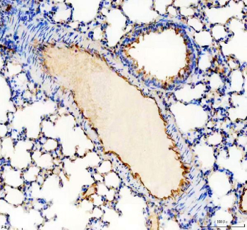 IHC staining of FFPE rat lung tissue with Cd31 antibody, HRP-secondary and DAB substrate. HIER: boil tissue sections in pH8 EDTA for 20 min and allow to cool before testing.