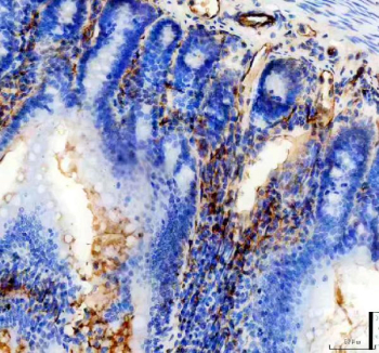 IHC staining of FFPE rat colon tissue with Cd31 antibody, HRP-secondary and DAB substrate. HIER: boil tissue sections in pH8 EDTA for 20 min and allow to cool before testing.