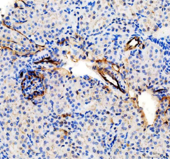 IHC staining of FFPE mouse kidney tissue with Cd31 antibody, HRP-secondary and DAB substrate. HIER: boil tissue sections in pH8 EDTA for 20 min and allow to cool before testing.