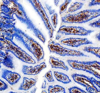 IHC staining of FFPE mouse colon tissue with Cd31 antibody, HRP-secondary and DAB substrate. HIER: boil tissue sections in pH8 EDTA for 20 min and allow to cool before testing.