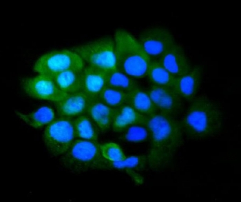 Immunofluorescence analysis of SLBP/Stem-Loop Binding Protein antibody in FFPE human A431 cells. SLBP antibody (green) demonstrates both nuclear and cytoplasmic staining, with nuclear signal overlapping DAPI (blue) and diffuse cytoplasmic distribution also observed. Heat-induced epitope retrieval was performed by steaming sections in pH6 citrate buffer for 20 min prior to staining.
