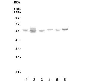 Western blot testing of human 1) HeLa, 2) A549, 3) U-87 MG, 4) A431, 5) HL60 and 6) K562 cell lysate with VMAT1 antibody. Predicted molecular weight ~56 kDa.