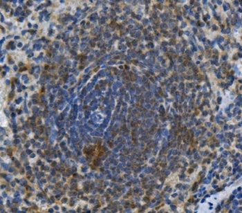 IHC staining of FFPE rat spleen with Toll-like Receptor 1 antibody. HIER: boil tissue sections in pH8 EDTA for 20 min and allow to cool before testing.