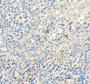 IHC staining of FFPE human tonsil tissue with Toll-like Receptor 1 antibody, HRP-secondary and DAB substrate. HIER: boil tissue sections in pH8 EDTA for 20 min and allow to cool before testing.