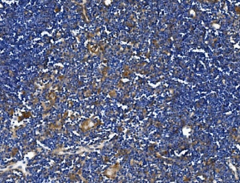 IHC staining of FFPE mouse thymus with TRIM6 antibody. HIER: boil tissue sections in pH8 EDTA for 20 min and allow to cool before testing.