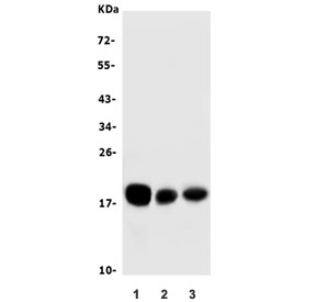 Western blot testing of human 1) HeLa, 2) U-87 MG and PC-3 cell lysate with CD59 antibody. Expected molecular weight: 14-20 kDa depending on level of glycosylation.