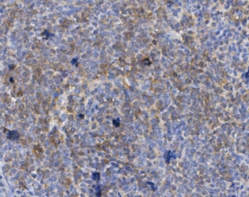 IHC staining of FFPE rat spleen with Cd72 antibody. HIER: boil tissue sections in pH8 EDTA for 20 min and allow to cool before testing.