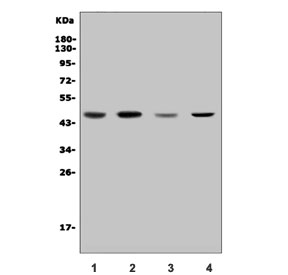 Western blot testing of human 1) Jurkat, 2) HEK293, 3) SW620 and 4) A549 cell lysate with CDC123 antibody. Predicted molecular weight ~45 kDa.