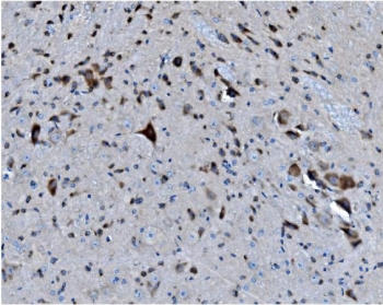 IHC staining of FFPE mouse brain with MAPK11 antibody. HIER: boil tissue sections in pH8 EDTA for 20 min and allow to cool before testing.