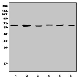 Western blot testing of 1) rat testis and human 2) HEK293, 3) HL60, 4) U-2 OS, 5) HepG2 and 6) A431 lysate with PARP2 antibody. Predicted molecular weight ~66 kDa.