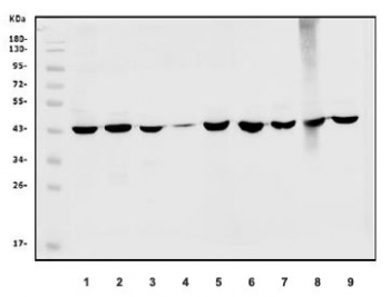 Western blot testing of 1) human HepG2, 2) human U937, 3) human K562, 4) human A431, 5) monkey kidney, 6) rat liver, 7) rat kidney, 8) mouse liver and 9) mouse kidney lysate with SORD antibody. Expected molecular weight: 38-42 kDa.