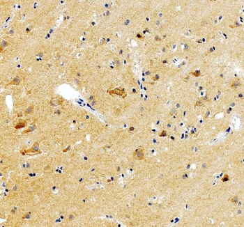 IHC staining of FFPE human brain tissue with GABRG2 antibody. HIER: boil tissue sections in pH8 EDTA for 20 min and allow to cool before testing.