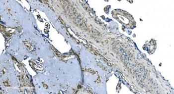 IHC staining of FFPE human placenta with GNG2 antibody. HIER: boil tissue sections in pH8 EDTA for 20 min and allow to cool before testing.