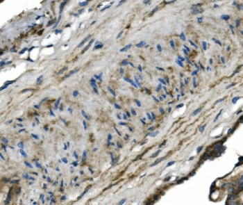 GNG4 Antibody for IHC. FFPE human placenta tissue stained with GNG4 antibody shows cytoplasmic and membranous staining in placental cells, consistent with G protein-coupled receptor signaling localization. A rabbit polyclonal format was used following HIER with pH8 EDTA buffer for antigen retrieval. Hematoxylin counterstain highlights nuclei (blue), while GNG4 signal is observed as brown staining within trophoblastic and stromal cell populations.