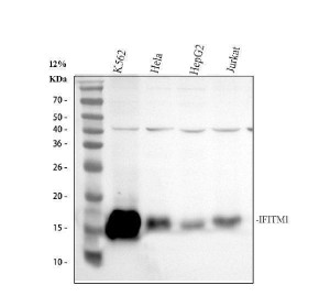 CD225 Antibody Human Cancer and Immune Cell WB. IFITM1 Antibody was used for Western blot analysis on lane 1: human K562, lane 2: human HeLa, lane 3: human HepG2, and lane 4: human Jurkat whole cell lysates. A distinct immunoreactive band is detected at approximately 14â17 kDa in each sample, consistent with the expected molecular weight of IFITM1. Variable expression is observed across the different cell lines, with the strongest signal detected in K562 cells. This IFITM1 Antibody / CD225 Antibody is well suited for Western blot studies of CD225 expression, interferon signaling, innate immunity, antiviral defense, and immune cell biology.