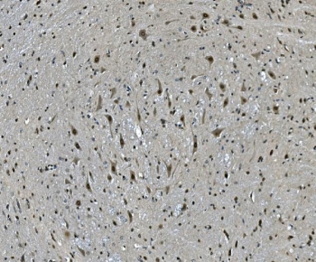 IHC staining of FFPE mouse brain with LSM7 antibody. HIER: boil tissue sections in pH8 EDTA for 20 min and allow to cool before testing.