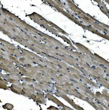 IHC staining of FFPE mouse heart with NDUFB5 antibody. HIER: boil tissue sections in pH8 EDTA for 20 min and allow to cool before testing.