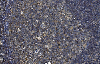 IHC staining of FFPE human tonsil tissue with OTULIN antibody. HIER: boil tissue sections in pH8 EDTA for 20 min and allow to cool before testing.
