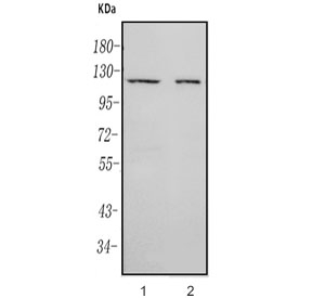 RAG1 Antibody Human T Cell and Mouse Thymus WB. Western blot analysis was performed using human Jurkat T cell lysate in lane 1 and mouse thymus tissue lysate in lane 2. The RAG1 antibody detected a distinct band near the predicted molecular weight of approximately 120 kDa in both samples. Detection in Jurkat cells and thymus tissue supports recognition of human and mouse RAG1 in lymphoid samples. RAG1 Antibody, recognizing recombination activating gene 1, supports research into VDJ recombination, antigen receptor formation and developing lymphocyte biology.