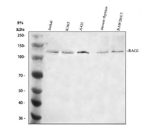 RAG1 Antibody Human and Mouse Cell and Thymus WB. Western blot analysis was performed under reducing conditions using 30 ug of lysate per lane. Lane 1: human Jurkat cells; Lane 2: human K562 cells; Lane 3: human A431 cells; Lane 4: mouse thymus tissue; Lane 5: mouse RAW264.7 cells. The membrane was incubated overnight at 4Â°C with rabbit anti-RAG1 antibody at 0.5 ug/ml, followed by an HRP-conjugated secondary antibody and ECL detection. A specific band was observed at approximately 119 kDa, matching the expected size of RAG1. RAG1 Antibody, recognizing recombination activating gene 1, supports studies of VDJ recombination and lymphocyte development.