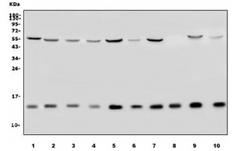 Western blot testing of human 1) HeLa, 2) MCF7, 3) PC-3, 4) K562, 5) HepG2, 6) monkey COS-7, 7) monkey kidney, 8) rat brain, 9) rat liver and 10) mouse liver lysate with TIMM8A antibody. Predicted molecular weight ~11 kDa.