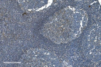 IHC staining of FFPE human tonsil with TIMM8A antibody. HIER: boil tissue sections in pH8 EDTA for 20 min and allow to cool before testing.