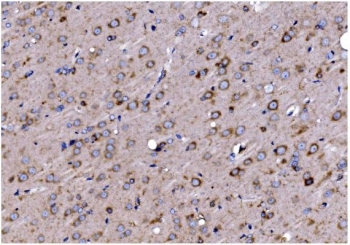 IHC staining of FFPE rat brain with TIMM8A antibody. HIER: boil tissue sections in pH8 EDTA for 20 min and allow to cool before testing.