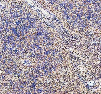IHC staining of FFPE human spleen tissue with CDK12 antibody. HIER: boil tissue sections in pH8 EDTA for 20 min and allow to cool before testing.