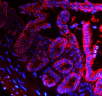 Epcam Antibody Mouse Intestine IF. Immunofluorescent staining of FFPE mouse intestine tissue using Epcam Antibody demonstrates strong red fluorescence localized predominantly to the epithelial lining of intestinal villi and crypt structures. The staining pattern is consistent with expression of Epithelial Cell Adhesion Molecule (EPCAM/CD326), a transmembrane glycoprotein involved in epithelial cell adhesion, maintenance of tissue architecture, and regulation of epithelial differentiation. Prominent membrane-associated fluorescence outlines the intestinal epithelial compartment and highlights the organized cellular structure of the mucosal lining. Nuclei are counterstained with DAPI (blue). The observed staining supports the use of Epcam as a marker for epithelial cell identification, intestinal epithelial biology, and studies of tissue organization and epithelial homeostasis in mouse tissues. HIER: steam tissue sections in pH 8 EDTA buffer for 20 minutes prior to staining.