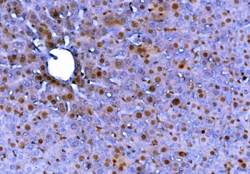 IHC staining of FFPE mouse liver with Fadd antibody. HIER: boil tissue sections in pH8 EDTA for 20 min and allow to cool before testing.