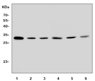 Western blot testing of 1) rat brain, 2) rat thymus, 3) rat PC-12, 4) mouse brain, 5) mouse thymus and 6) mouse NIH 3T3 lysate with Fadd antibody. Predicted molecular weight ~23 kDa, commonly observed at 23-28 kDa.