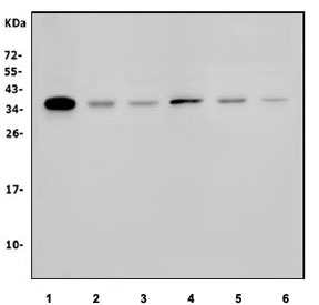 Western blot testing of 1) human COLO-320, 2) human U-2 OS, 3) human A549, 4) rat brain, 5) mouse brain and 6) mouse ovary lysate with HOXC8 antibody. Expected molecular weight: 27-35 kDa.