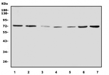 Western blot testing of human 1) HeLa, 2) HEK293, 3) K562, 4) ThP-1, 5) rat PC-12, 6) mouse intestine and 7) mouse RAW264.7 lysate with IL2RB antibody. Expected molecular weight ~61 kDa (unmodified), 70-75 kDa (glycosylated).