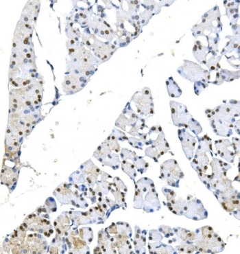 IHC staining of FFPE rat pancreas with METTL1 antibody. HIER: boil tissue sections in pH8 EDTA for 20 min and allow to cool before testing.
