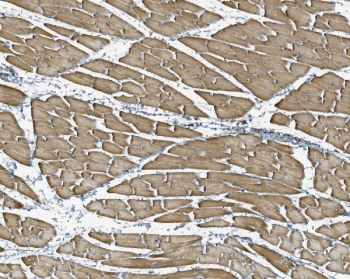 IHC staining of FFPE rat skeletal muscle with NDUFB10 antibody. HIER: boil tissue sections in pH8 EDTA for 20 min and allow to cool before testing.