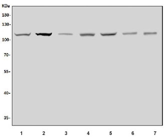 NALP3 Antibody Multi-Species WB. Western blot analysis of 1) human HeLa, 2) human U-87 MG, 3) rat spleen, 4) rat PC-12, 5) mouse thymus, 6) mouse lung, and 7) mouse spleen lysates using NALP3 Antibody. Bands are detected near approximately 110-120 kDa across multiple human, rat, and mouse samples, consistent with the predicted molecular weight of NLRP3 / NALP3 / Cryopyrin, an innate immune signaling protein involved in inflammasome activation, inflammatory regulation, cytokine maturation, and pyroptosis-associated cellular pathways.