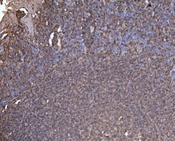IHC staining of FFPE human tonsil with RAB1B antibody. HIER: boil tissue sections in pH8 EDTA for 20 min and allow to cool before testing.