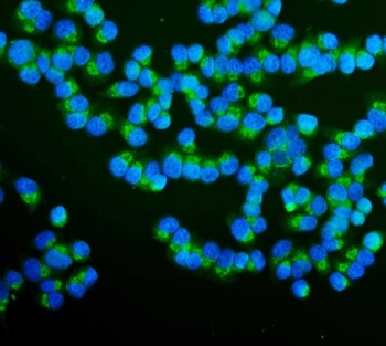 Immunofluorescent staining of FFPE human T-47D cells with RAB1B antibody (green) and DAPI nuclear stain (blue). HIER: steam section in pH6 citrate buffer for 20 min.