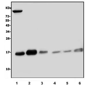 Western blot testing of 1) rat heart, 2) rat lung, 3) rat liver, 4) human HEK293, 5) human Jurkat and 6) human Caco-2 lysate with UBE2D1/2/3/4 antibody. Predicted molecular weight ~17 kDa.
