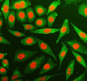YTHDC1 Antibody SiHa Cell IF. Immunofluorescence analysis of YTHDC1 Antibody / Nuclear m6A Reader Protein Antibody in SiHa cells. Cells were subjected to enzyme antigen retrieval, stained with YTHDC1 antibody at 5 ug/ml and co-labeled with an alpha tubulin antibody. YTHDC1 is shown in red, alpha tubulin in green and nuclei were counterstained with DAPI. The staining demonstrates predominant nuclear localization of YTHDC1, consistent with its role as a nuclear m6A reader that regulates RNA splicing, mRNA export and epitranscriptomic gene regulation. This YTHDC1 Antibody, a Nuclear m6A Reader Protein Antibody, is suitable for investigating subcellular localization and RNA processing pathways by immunofluorescence.
