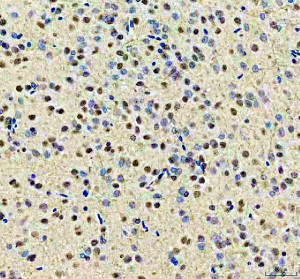 YTHDC1 Antibody Rat Brain IHC. Immunohistochemical analysis of YTHDC1 Antibody / Nuclear m6A Reader Protein Antibody in FFPE rat brain tissue. Following heat-induced epitope retrieval in pH 8.0 EDTA buffer, sections were stained with YTHDC1 antibody at 2 ug/ml and detected using an HRP-conjugated secondary antibody with DAB chromogen. Strong nuclear staining is observed throughout the brain tissue, consistent with the predominantly nuclear localization of YTHDC1 as an m6A RNA reader involved in RNA processing and gene regulation. This YTHDC1 Antibody, a Nuclear m6A Reader Protein Antibody, is suitable for investigating nuclear RNA metabolism and epitranscriptomic regulation in tissue sections.