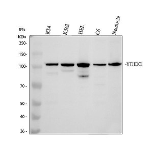 YTHDC1 Antibody Human, Rat and Mouse WB. Western blot analysis of YTHDC1 Antibody / Nuclear m6A Reader Protein Antibody detected endogenous YTHDC1 in whole cell lysates. Lane 1: human RT4 cells; Lane 2: human K562 cells; Lane 3: human HEL cells; Lane 4: rat C6 cells; Lane 5: mouse Neuro-2a cells. A rabbit polyclonal YTHDC1 antibody was used at 0.5 ug/ml. A prominent band is detected at approximately 110 kDa, although the predicted molecular weight of YTHDC1 is approximately 85 kDa. The higher apparent molecular weight is consistent with the anomalous migration reported for YTHDC1. This YTHDC1 Antibody, a Nuclear m6A Reader Protein Antibody, demonstrates cross-species detection suitable for studies of RNA methylation, RNA processing and epitranscriptomic regulation.