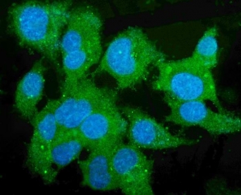 Immunofluorescent staining of FFPE human HepG2 cells with CES1 antibody (green) and DAPI nuclear stain (blue). HIER: steam section in pH6 citrate buffer for 20 min.