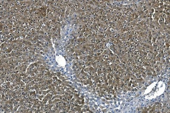 IHC staining of FFPE rat liver with ASS1 antibody. HIER: boil tissue sections in pH8 EDTA for 20 min and allow to cool before testing.