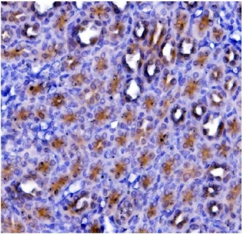 IHC staining of FFPE rat kidney with eRF1 antibody. HIER: boil tissue sections in pH8 EDTA for 20 min and allow to cool before testing.
