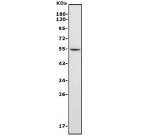 Western blot testing of human HepG2 cell lysate with FGB antibody. Predicted molecular weight ~56 kDa.