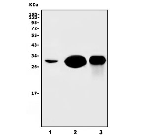Western blot testing of 1) human K562, 2) rat spleen and 3) mouse spleen lysate with Carbonic Anhydrase I antibody. Predicted molecular weight: ~29 kDa.