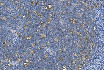 IHC staining of FFPE human tonsil with CA1 antibody. HIER: boil tissue sections in pH8 EDTA for 20 min and allow to cool before testing.