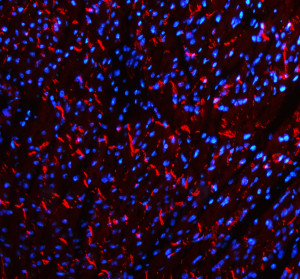Cadherin 2 Antibody Mouse Cardiac Tissue IF. Immunofluorescent staining of FFPE mouse heart tissue with Cadherin 2 Antibody at 5 ug/ml demonstrates CDH2 expression (red). Heat-induced epitope retrieval was performed in pH8 EDTA buffer, followed by blocking with 10% goat serum. Sections were incubated with primary antibody overnight at 4Â°C, followed by Cy3-conjugated secondary antibody, with DAPI nuclear counterstain (blue). Red fluorescence demonstrates Cadherin 2 localization within the cardiac tissue. This Cadherin 2 Antibody, also called CDH2 Antibody, supports studies of N-Cadherin expression, cell-cell adhesion, and cardiac biology.
